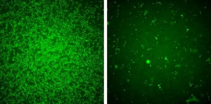 First Look At How Our Cells Can Swallow Up And Quarantine Zika 7419