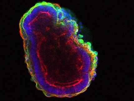 A gene called Prkci helps organize organisms and their organs