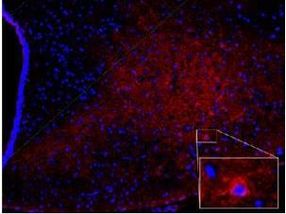 A broken calorie sensing pathway