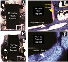 Bioactive film improves how implants bond with bone in animal study