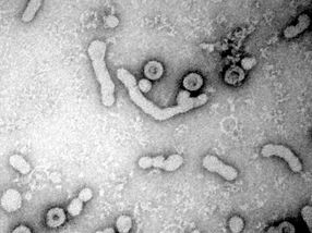 Hepatitis-B-Viren als tickende Zeitbomben