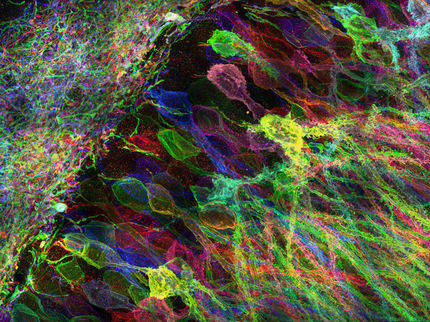 Seeing RNA at the nanoscale