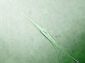 Fibroblast