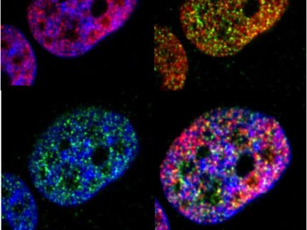 Immunofluorescent breast cancer cells