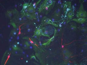 Cerebrospinal fluid signals control the behavior of stem cells in the brain