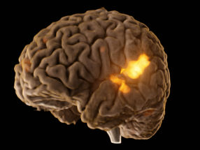 The Glowing Brain