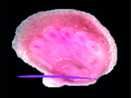 Liveschaltung während der Tumorbestrahlung