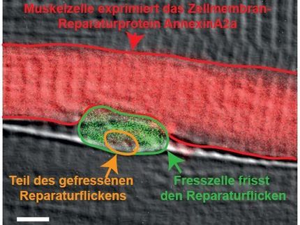 Fresszellen reparieren Muskelfasern