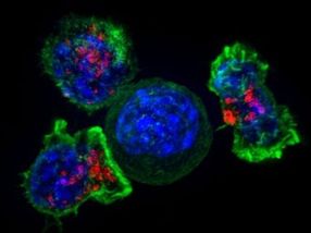‘Cellbots’ chase down cancer, deliver drugs directly to tumors