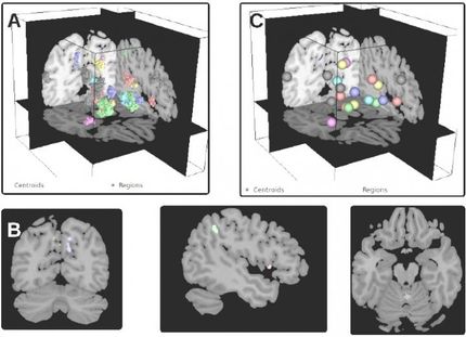 Brain modulyzer provides interactive window into the brain