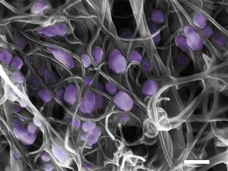 New, carbon-nanotube tool for ultra-sensitive virus detection and identification