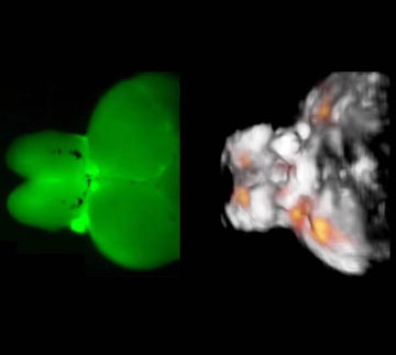 Dem Gehirn bei der Arbeit zuschauen