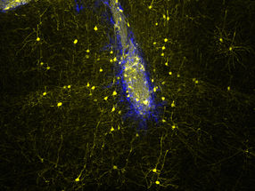 Neue Nervenzellen fürs Gehirn