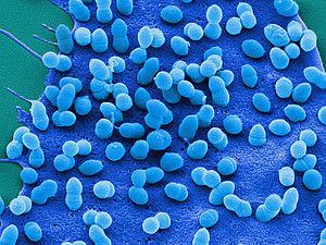 Mathematik klärt Reaktionen des Immunsystems auf