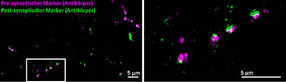 Peptide als Marker in der Fluoreszenz-Mikroskopie