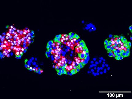 Durchbruch in der Diabetesforschung