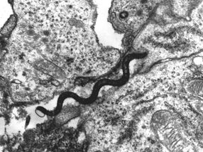 Pandemische Erregergruppe verantwortlich für Syphilis-Rückkehr