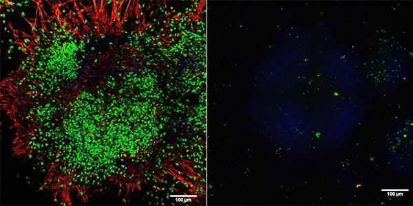 Courtesy of Dr. Xiang Li, La Jolla Institute for Allergy and Immunology.