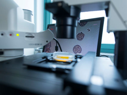 Fraunhofer: científicos descubren nuevos mecanismos de propagación precoz del cáncer de mama