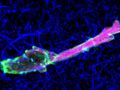 Tumor cells move differently than normal ones