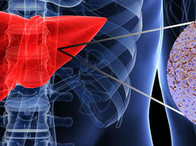Ein weiteres Puzzlestück bei der Entwicklung von Leberkrebs identifiziert