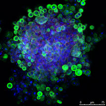 Umprogrammierbare Hautstammzellen in der Petrischale