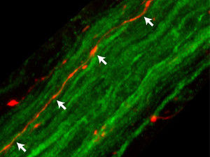 An Parkinson beteiligtes Protein reist vom Hirn zum Magen