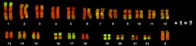 How well do we understand the relation between incorrect chromosome number & cancer?