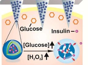 Toward a 'smart' patch that automatically delivers insulin when needed