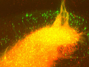 Tollwutviren zeigen Verschaltungen im gläsernen Gehirn