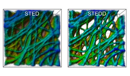 Background suppression for super-resolution light microscopy