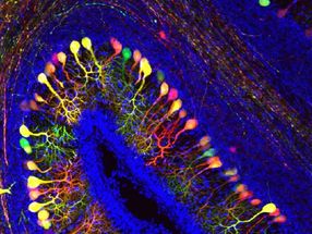 Transporter of thyroid hormones crucial for embryonal brain development