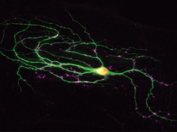 © MPI f. experimentelle Medizin