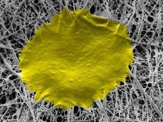 A nanofiber matrix for healing
