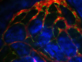 Stammzellen verlassen Blutgefäße in strömungsarmen Zonen des Knochenmarks