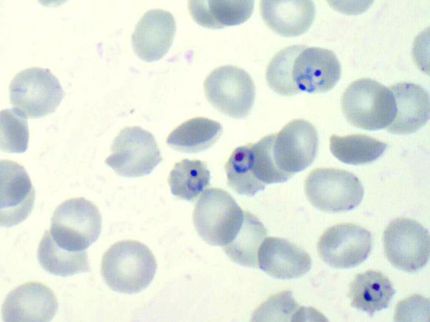 Hoch wirksamer Malaria-Impfstoff erfolgreich getestet