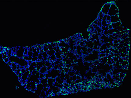 Erster Atemzug prägt Immunsystem nachhaltig