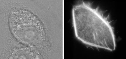 Nanoinjektion steigert Überlebensrate von Zellen