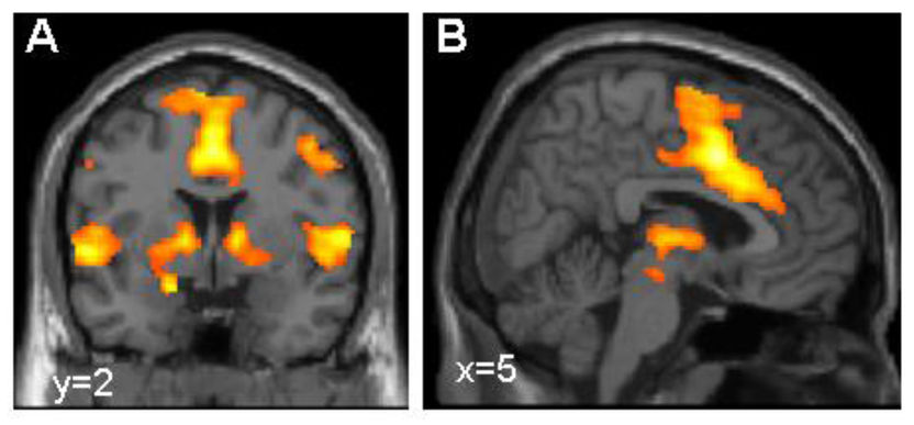 Dr. Tina Lonsdorf, Systemische Neurowissenschaften UKE Hamburg