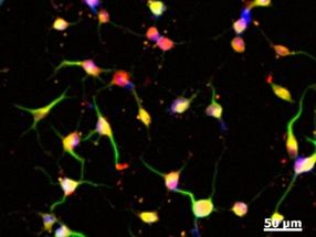 From skin to brain: Stem cells without genetic modification