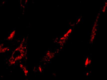 Toward glow-in-the-dark tumors