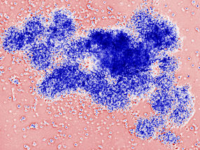 Nierentransplantationen: Weisse Blutzellen kontrollieren Virusvermehrung