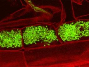 Feeding fat to fungi: Evidence for lipid transfer in arbuscular mycorrhiza