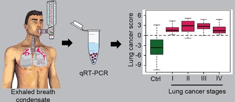 Cancer Diagnosis With A Breath Test - A New Test For The Early ...