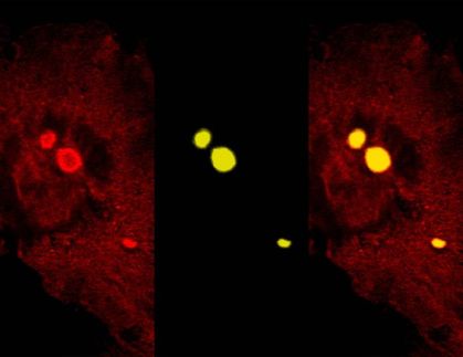 The protein “CHIP” unfurls anti-aging activity