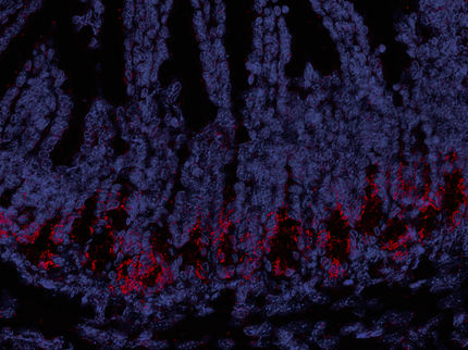 Stem cell transplants: activating signal paths may protect from graft-versus-host disease