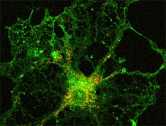 Max-Planck-Institut für Experimentelle Medizin