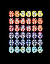 Gray matter density increases during adolescence