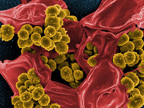Lässt sich mit Boten-RNA das Immunsystem gegen Staphylococcus aureus scharf schalten?