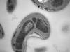Newly identified microbial process could reduce toxic methylmercury levels